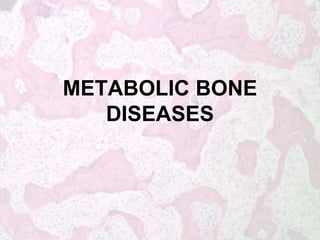 METABOLIC BONE 
DISEASES 
 