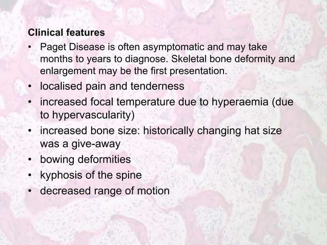 Metabolic Bone Diseases