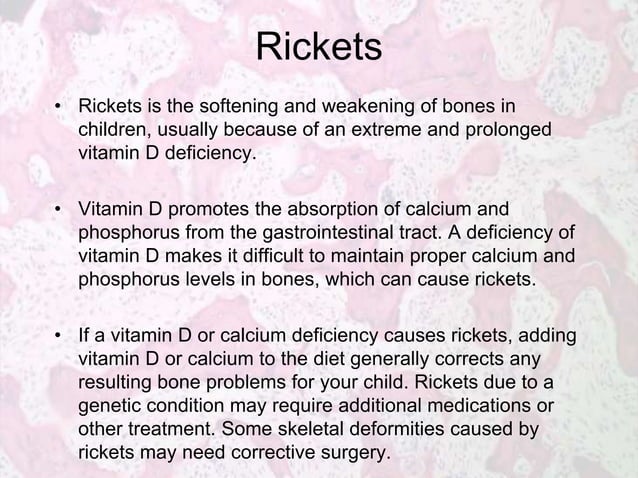 Metabolic Bone Diseases