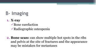 B- Imaging
1. X-ray
Bone rarefaction
Radiographic osteopenia
2. Bone scan: can show multiple hot spots in the ribs
and pelvis at the site of fractures and the appearance
may be mistaken for metastases
 