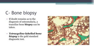 C- Bone biopsy
• If doubt remains as to the
diagnosis of osteomalacia, a
transiliac bone biopsy can be
taken.
• Tetracycline-labelled bone
biopsy is the gold standard
diagnostic test.
 