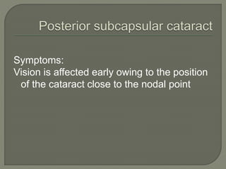 Symptoms:
Vision is affected early owing to the position
of the cataract close to the nodal point
 