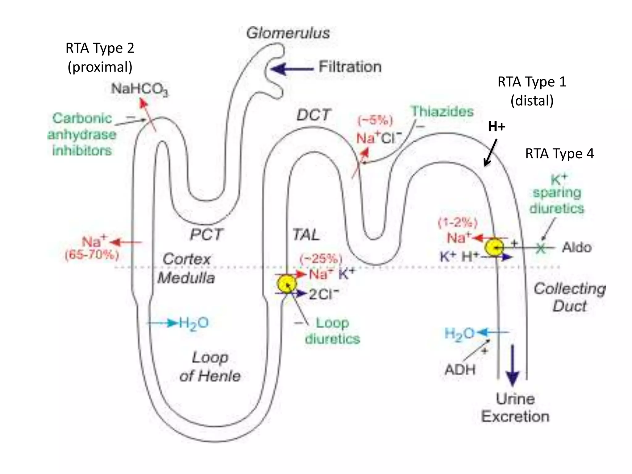 Distal Rta Patho Metabolic disorders | PPTX