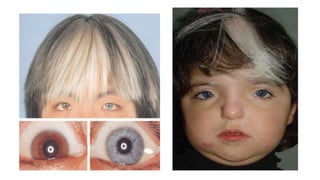 Highlight Inborn Approach to inborn errors of metabolism .pptx