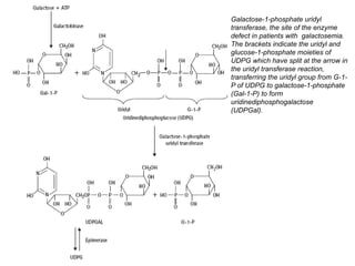 Galactose-1-phosphate uridyl
transferase, the site of the enzyme
defect in patients with galactosemia.
The brackets indicate the uridyl and
glucose-1-phosphate moieties of
UDPG which have split at the arrow in
the uridyl transferase reaction,
transferring the uridyl group from G-1-
P of UDPG to galactose-1-phosphate
(Gal-1-P) to form
uridinediphosphogalactose
(UDPGal).
 