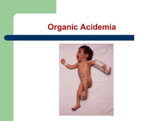 Organic Acidemia
 