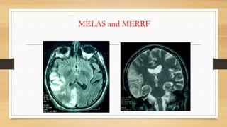 Metabolic disorders in neurology | PPTX