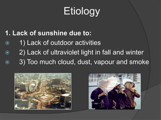 Etiology
1. Lack of sunshine due to:
 1) Lack of outdoor activities
 2) Lack of ultraviolet light in fall and winter
 3) Too much cloud, dust, vapour and smoke
 