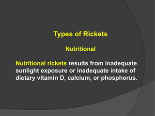 Types of Rickets
Nutritional
Nutritional rickets results from inadequate
sunlight exposure or inadequate intake of
dietary vitamin D, calcium, or phosphorus.
 