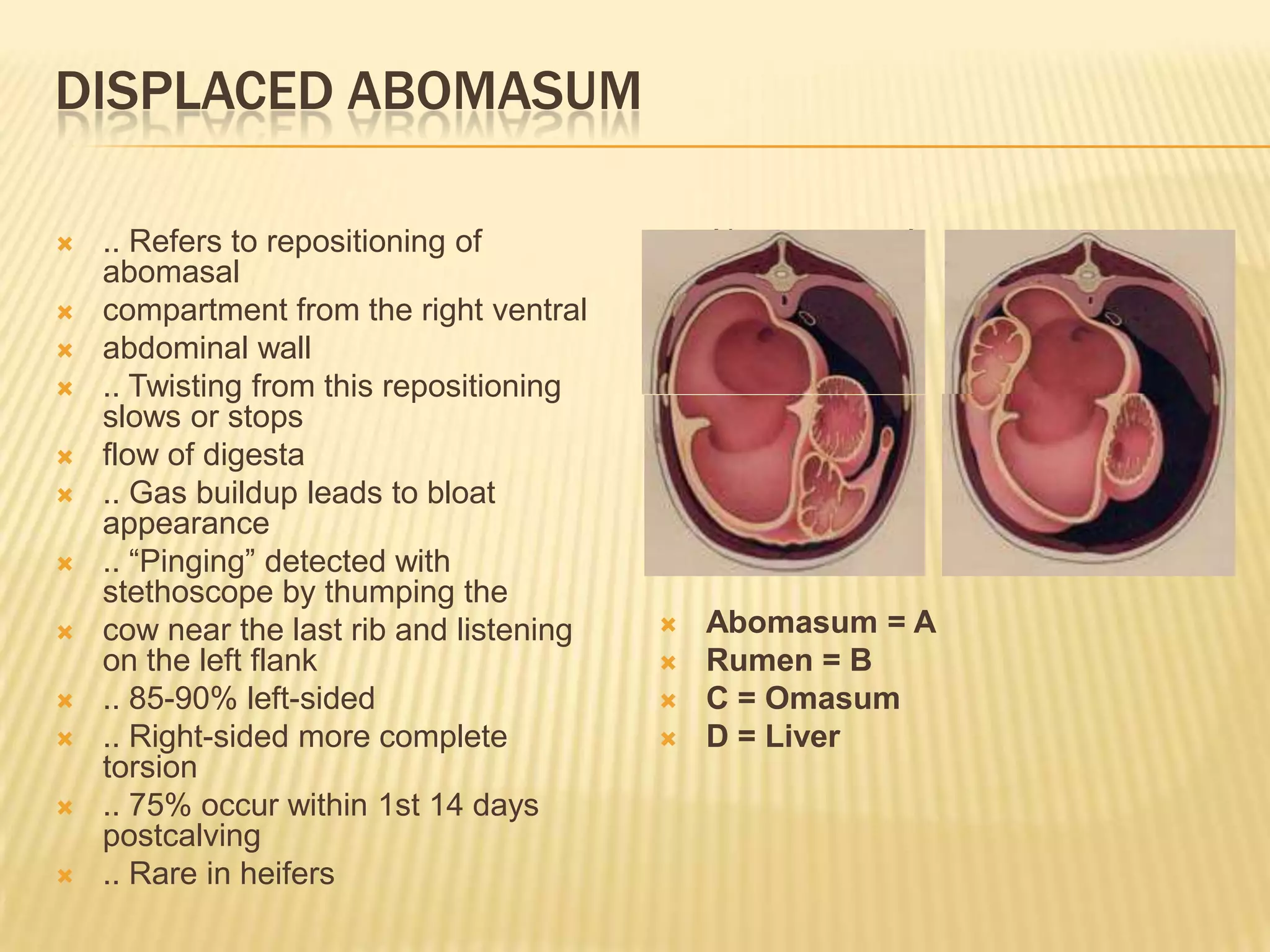 DISPLACED ABOMASUM
 .. Refers to repositioning of
abomasal
 compartment from the right ventral
 abdominal wall
 .. Twisting from this repositioning
slows or stops
 flow of digesta
 .. Gas buildup leads to bloat
appearance
 .. “Pinging” detected with
stethoscope by thumping the
 cow near the last rib and listening
on the left flank
 .. 85-90% left-sided
 .. Right-sided more complete
torsion
 .. 75% occur within 1st 14 days
postcalving
 .. Rare in heifers
 Abomasum = A
 Rumen = B
 C = Omasum
 Abomasum = A
 Rumen = B
 C = Omasum
 D = Liver
 