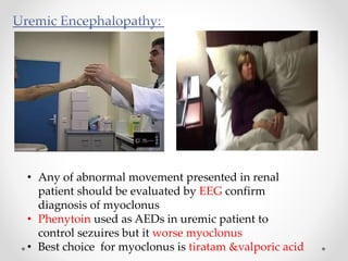 • Any of abnormal movement presented in renal
patient should be evaluated by EEG confirm
diagnosis of myoclonus
• Phenytoin used as AEDs in uremic patient to
control sezuires but it worse myoclonus
• Best choice for myoclonus is tiratam &valporic acid
 