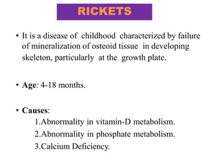 • It is a disease of childhood characterized by failure
of mineralization of osteoid tissue in developing
skeleton, particularly at the growth plate.
• Age: 4-18 months.
• Causes:
1.Abnormality in vitamin-D metabolism.
2.Abnormality in phosphate metabolism.
3.Calcium Deficiency.
RICKETS
 