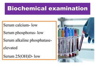 Serum calcium- low
Serum phosphorus- low
Serum alkaline phosphatase-
elevated
Serum 25(OH)D- low
Biochemical examination
 