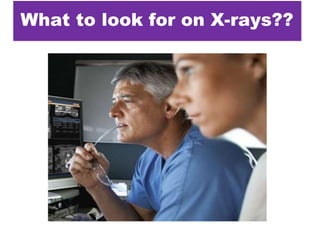 What to look for on X-rays??
 