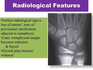 •Earliest radiological sign is
loss of normal zone of
provisional calcification
adjacent to metaphysis.
•Later, metaphyseal margin
becomes indistinct
& frayed.
•Growth plate become
widened.
Radiological Features
 