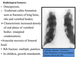 Radiological features:
• Osteoporosis.
 Exuberant callus formation
seen at fractures of long bone,
ribs and vertebral bodies.
 Characteristic increased density
of end plates of vertebral
bodies (marginal
condensation).
•Avascular necrosis of femoral
head.
• Rib fracture- multiple, painless.
• In children, growth retardation.
Cushing’s disease : Excessive
callus formation is seen at multiple
fracture sites in the ribs.
 