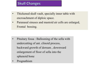 • Thickened skull vault, specially inner table with
encroachment of diploic space.
• Paranasal sinuses and mastoid air cells are enlarged,
Frontal bossing.
• Pituitary fossa : Ballooning of the sella with
undercutting of ant. clinoid process,
backward growth of dorsum , downward
enlargement of floor of sella into the
sphenoid bone
• Prognathism
 