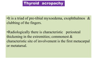 Thyroid acropachy
•It is a triad of pre-tibial myxoedema, exophthalmos &
clubbing of the fingers.
•Radiologically there is characteristic periosteal
thickening in the extremities; commonest &
characteristic site of involvement is the first metacarpal
or metatarsal.
 