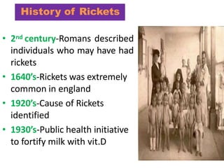 History of Rickets
• 2nd century-Romans described
individuals who may have had
rickets
• 1640’s-Rickets was extremely
common in england
• 1920’s-Cause of Rickets
identified
• 1930’s-Public health initiative
to fortify milk with vit.D
 