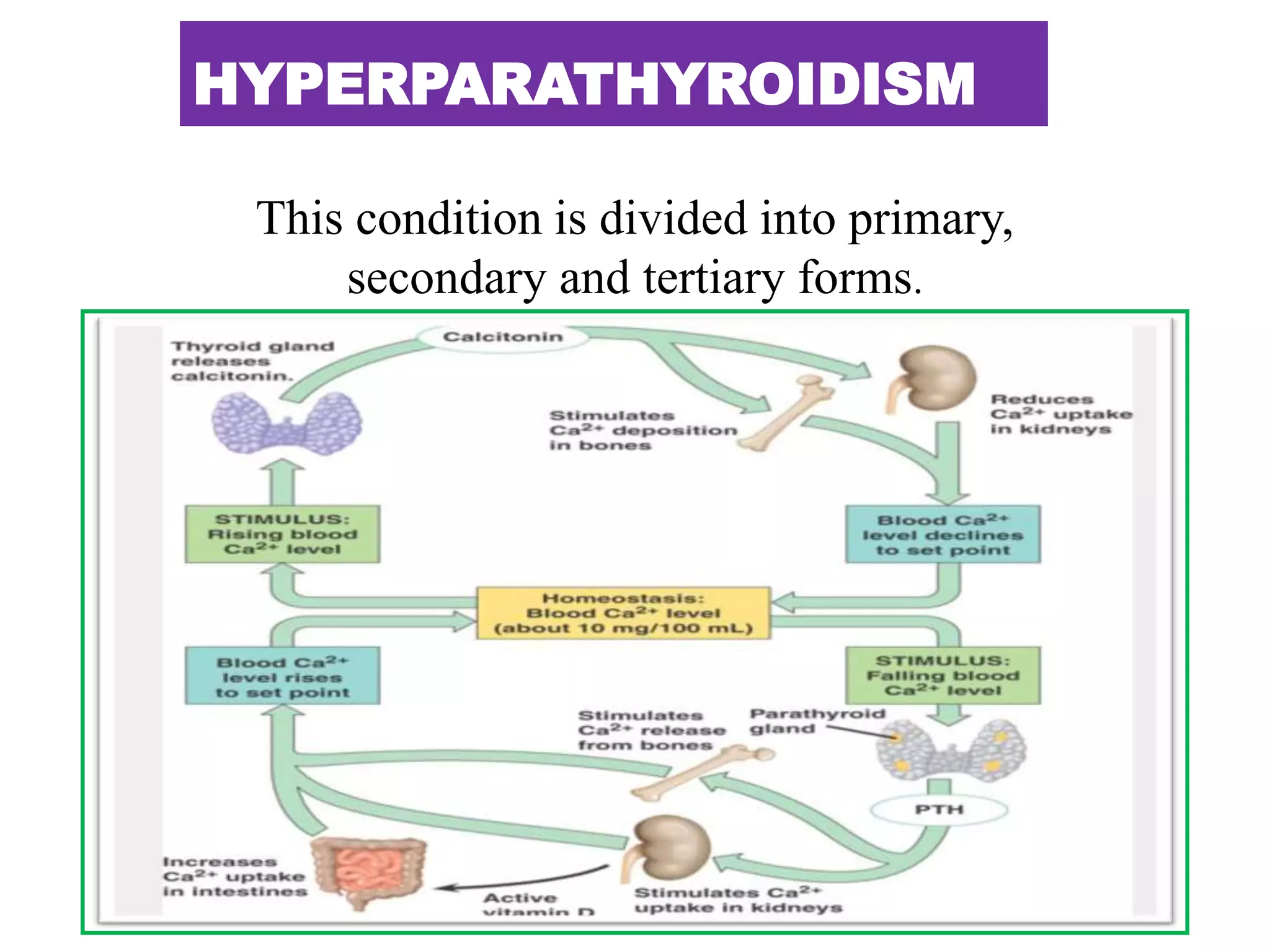 HYPERPARATHYROIDISM
This condition is divided into primary,
secondary and tertiary forms.
 