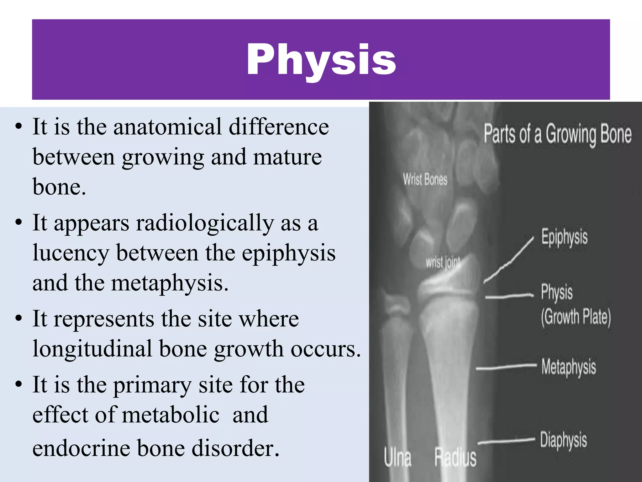 Physis
• It is the anatomical difference
between growing and mature
bone.
• It appears radiologically as a
lucency between the epiphysis
and the metaphysis.
• It represents the site where
longitudinal bone growth occurs.
• It is the primary site for the
effect of metabolic and
endocrine bone disorder.
 