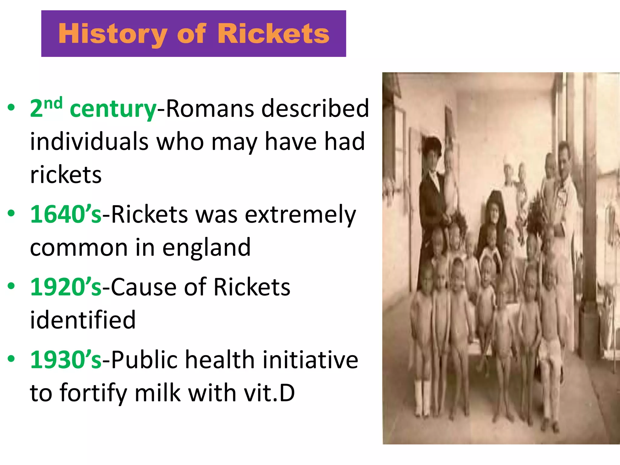History of Rickets
• 2nd century-Romans described
individuals who may have had
rickets
• 1640’s-Rickets was extremely
common in england
• 1920’s-Cause of Rickets
identified
• 1930’s-Public health initiative
to fortify milk with vit.D
 