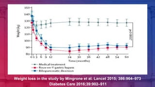 Weight loss in the study by Mingrone et al. Lancet 2015; 386:964–973
Diabetes Care 2016;39:902–911
 