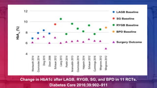 Change in HbA1c after LAGB, RYGB, SG, and BPD in 11 RCTs.
Diabetes Care 2016;39:902–911
 