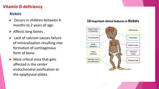 Vitamin D deficiency
Rickets
 Occurs in children between 6
months to 2 years of age.
 Affects long bones .
 Lack of calcium causes failure
of mineralization resulting into
formation of cartilagenous
form of bone.
 Most critical area that gets
affected is the center
endochondral ossification at
the epiphyseal plates.
 