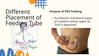 METABOLISM NGT Feeding PEG Feeding CBG Monitoring SubcutaneousInsulin ...