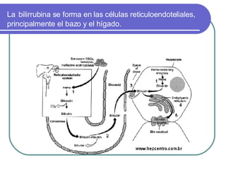 La   bilirrubina se forma en las células reticuloendoteliales, principalmente el bazo y el hígado. 
