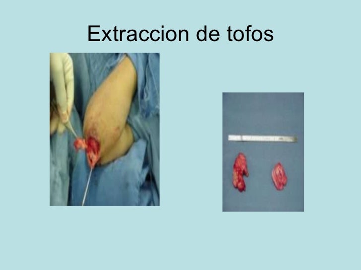 ¿Por dónde empezar con metabolismo basal alto?