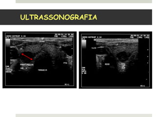 ULTRASSONOGRAFIA
 
