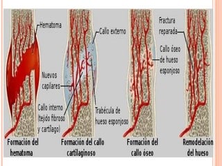 Metabolismo del cacio y ect3