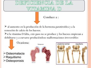  al aumento en la producción de la hormona paratiroidea y a la
remoción de calcio de los huesos.
si la vitamina D falta, este paso no se produce y los huesos empiezan a
debilitarse y a curvarse produciéndose malformaciones irreversibles
Conduce a :
Osteomalacia
Raquitismo
Osteoporosis
Ocasiona:
 