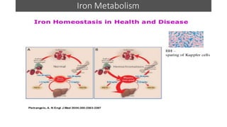 Metabolism of iron and its clinical significance | PDF