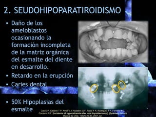 B. Fisiopatología
Características del
seudohipoparatiroidismo (SHP)
SHP 1A SSHP SHP 1B
Hipocalcemia Sí No Sí
Respuesta a l...