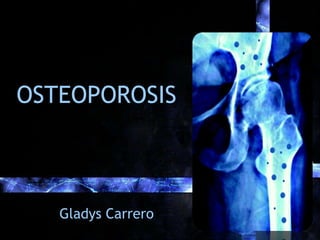 Cooper C, Melton LJ III: Epidemiology of osteoporosis. Trends Endocrinol Metab 1992;314:224
 