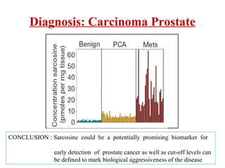 CONCLUSION : Sarcosine could be a potentially promising biomarker for
early detection of prostate cancer as well as cut-off levels can
be defined to mark biological aggressiveness of the disease
Diagnosis: Carcinoma Prostate
 