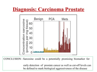 Diagnostics of Prostate Cancer
• Application of blood plasma metabolites fingerprinting for
diagnosis of II stage of prost...