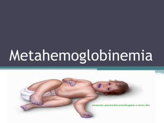 Metahemoglobinemia
 