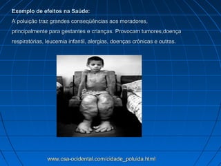 Exemplo de efeitos na Saúde:
A poluição traz grandes conseqüências aos moradores,
principalmente para gestantes e crianças. Provocam tumores,doença
respiratórias, leucemia infantil, alergias, doenças crônicas e outras.




               www.csa-ocidental.com/cidade_poluida.html
 