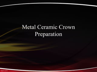 Metal Ceramic Crown
Preparation
 