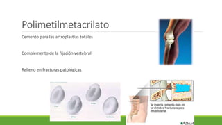 Polimetilmetacrilato
Cemento para las artroplastías totales
Complemento de la fijación vertebral
Relleno en fracturas patológicas
 