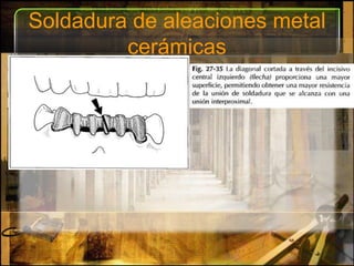 Soldadura de aleaciones metal cerámicas