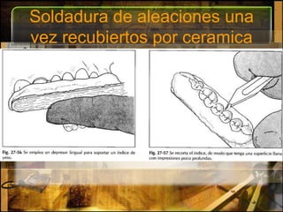 Soldadura de aleaciones una vez recubiertos por ceramica