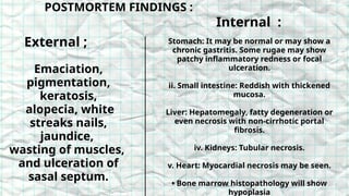 Stomach: It may be normal or may show a
chronic gastritis. Some rugae may show
patchy inflammatory redness or focal
ulceration.
ii. Small intestine: Reddish with thickened
mucosa.
Liver: Hepatomegaly, fatty degeneration or
even necrosis with non-cirrhotic portal
fibrosis.
iv. Kidneys: Tubular necrosis.
v. Heart: Myocardial necrosis may be seen.
• Bone marrow histopathology will show
hypoplasia
Emaciation,
pigmentation,
keratosis,
alopecia, white
streaks nails,
jaundice,
wasting of muscles,
and ulceration of
sasal septum.
POSTMORTEM FINDINGS :
External ;
Internal :
 