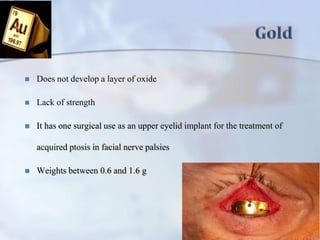  Does not develop a layer of oxide
 Lack of strength
 It has one surgical use as an upper eyelid implant for the treatment of
acquired ptosis in facial nerve palsies
 Weights between 0.6 and 1.6 g
 
