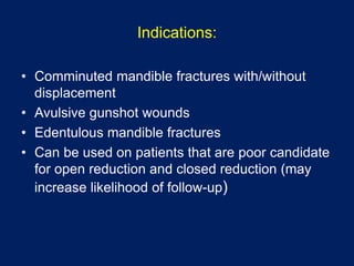 Indications:
• Comminuted mandible fractures with/without
displacement
• Avulsive gunshot wounds
• Edentulous mandible fractures
• Can be used on patients that are poor candidate
for open reduction and closed reduction (may
increase likelihood of follow-up)
 