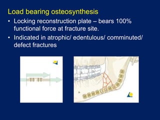 Load bearing osteosynthesis
• Locking reconstruction plate – bears 100%
functional force at fracture site.
• Indicated in atrophic/ edentulous/ comminuted/
defect fractures
 